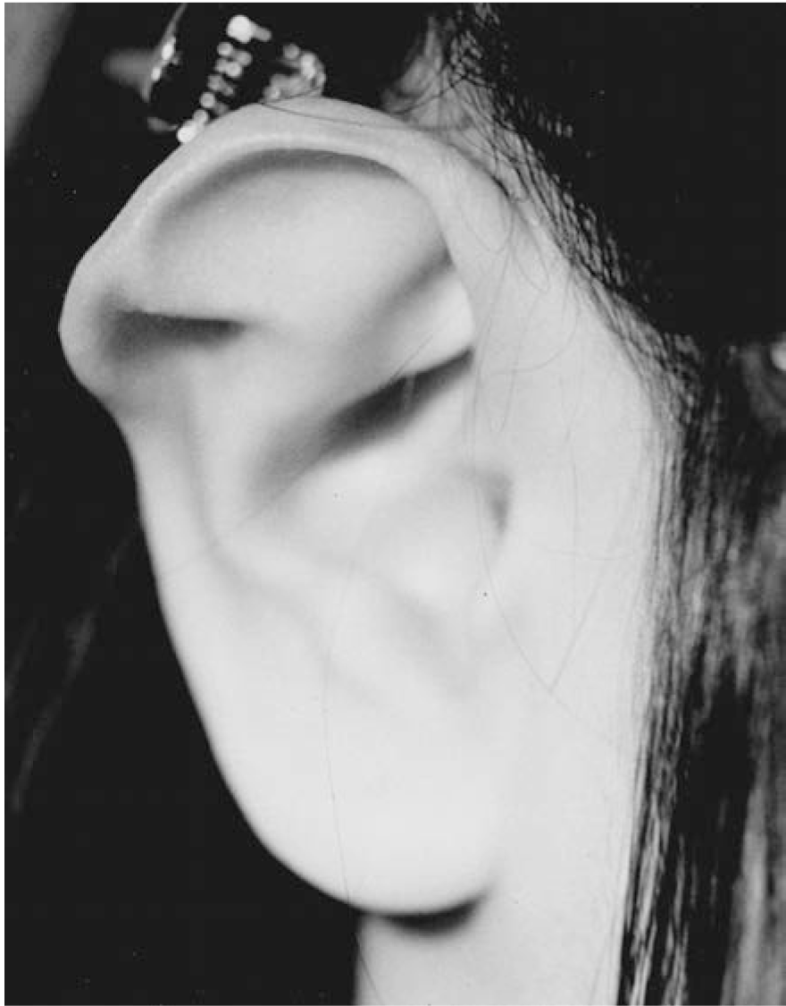 stahls ear